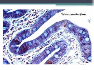 Tejido conectivo (laxo)
 