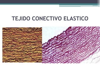 TEJIDO CONECTIVO ELASTICO
 