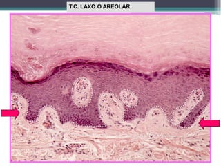 T.C. LAXO O AREOLAR
 
