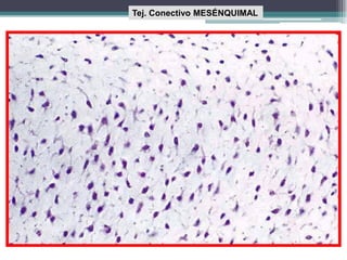 Tej. Conectivo MESÉNQUIMAL
 