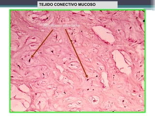 TEJIDO CONECTIVO MUCOSO
fibroblastos estrellados
 