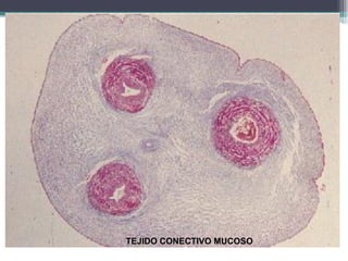 TEJIDO CONECTIVO MUCOSO
 