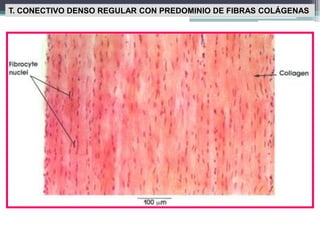 T. CONECTIVO DENSO REGULAR CON PREDOMINIO DE FIBRAS COLÁGENAS
 