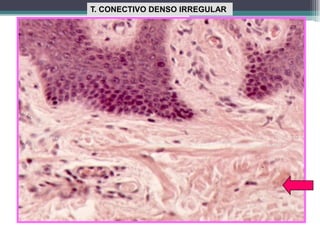 T. CONECTIVO DENSO IRREGULAR
 
