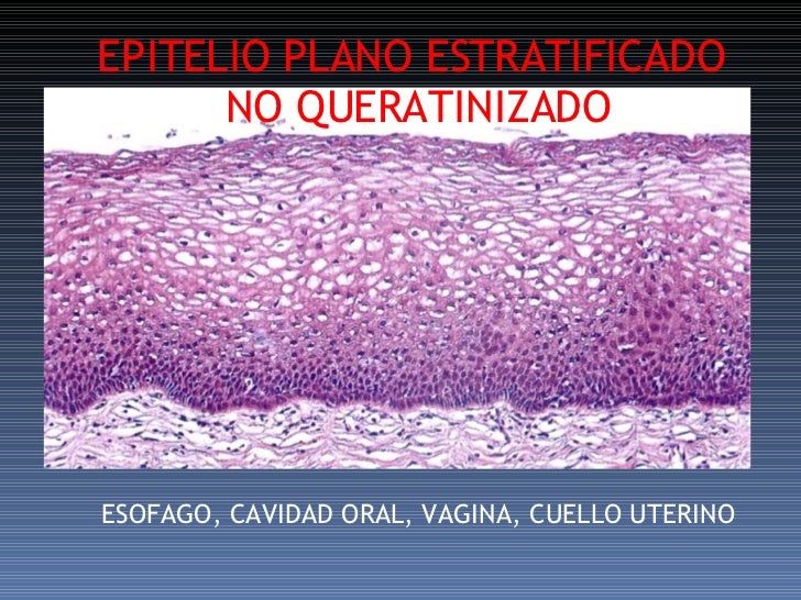 TeJido Epitelial