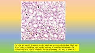 Fig 5-2.A, Micrografía de epitelio simple: Epitelio escamoso simple (flechas). Obsérvese
la morfología de las células y sus núcleos. También se muestra un epitelio cuboide
simple (cabezas de flechas). Nótense los núcleos redondos, colocados en el centro.
 