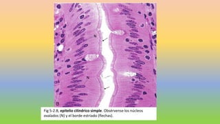 Fig 5-2.B, epitelio cilíndrico simple. Obsérvense los núcleos
ovalados (N) y el borde estriado (flechas).
N
N
 