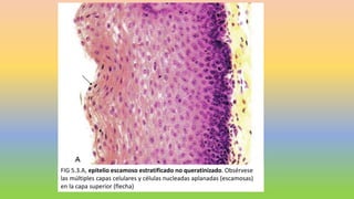FIG 5.3.A, epitelio escamoso estratificado no queratinizado. Obsérvese
las múltiples capas celulares y células nucleadas aplanadas (escamosas)
en la capa superior (flecha)
 