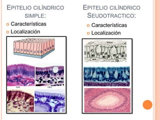 EPITELIO CILÍNDRICO
SIMPLE:
 Características
 Localización
 Características
 Localización
EPITELIO CILÍNDRICO
SEUDOTRACTICO:
 