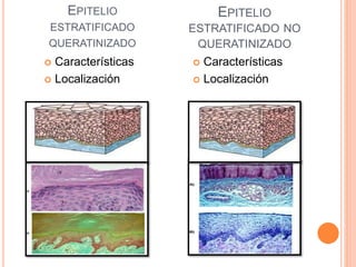 EPITELIO
ESTRATIFICADO
QUERATINIZADO
EPITELIO
ESTRATIFICADO NO
QUERATINIZADO
 Características
 Localización
 Características
 Localización
 
