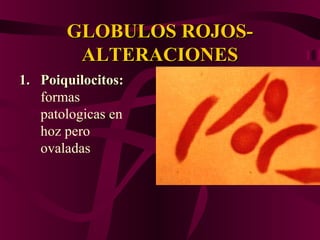 GLOBULOS ROJOS-GLOBULOS ROJOS-
ALTERACIONESALTERACIONES
1.1. Poiquilocitos:Poiquilocitos:
formas
patologicas en
hoz pero
ovaladas
 
