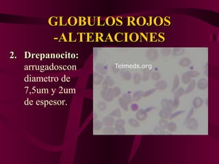 GLOBULOS ROJOSGLOBULOS ROJOS
-ALTERACIONES-ALTERACIONES
2.2. Drepanocito:Drepanocito:
arrugadoscon
diametro de
7,5um y 2um
de espesor.
 