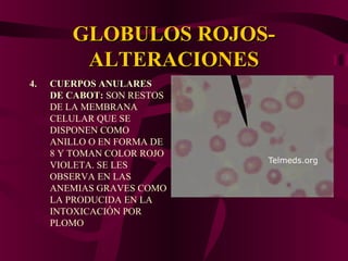 GLOBULOS ROJOS-GLOBULOS ROJOS-
ALTERACIONESALTERACIONES
4.4. CUERPOS ANULARESCUERPOS ANULARES
DE CABOT:DE CABOT: SON RESTOS
DE LA MEMBRANA
CELULAR QUE SE
DISPONEN COMO
ANILLO O EN FORMA DE
8 Y TOMAN COLOR ROJO
VIOLETA. SE LES
OBSERVA EN LAS
ANEMIAS GRAVES COMO
LA PRODUCIDA EN LA
INTOXICACIÓN POR
PLOMO
 