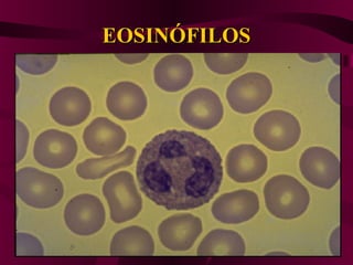 EOSINÓFILOSEOSINÓFILOS
 