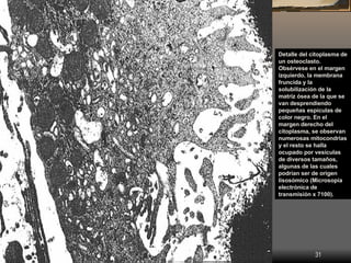 Detalle del citoplasma de
           un osteoclasto.
           Obsérvese en el margen
           izquierdo, la membrana
 ...