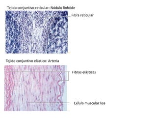Tejido conjuntivo reticular: Nódulo linfoide
Fibra reticular
Fibras elásticas
Célula muscular lisa
Tejido conjuntivo elástico: Arteria
 