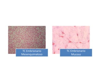 TC Embrionario
Mesenquimatoso
TC Embrionario
Mucoso
 