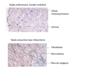 Célula
mesenquimatosa
Amnios
Tejido embrionario: Cordón umbilical
Fibroblasto
Fibra elástica
Fibra de colágeno
Tejido conjuntivo laxo: Mesenterio
 
