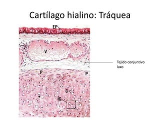 Cartílago hialino: Tráquea
Tejido conjuntivo
laxo
 
