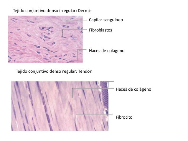 Resultado de imagen de tejido conectivo irregular denso tendon