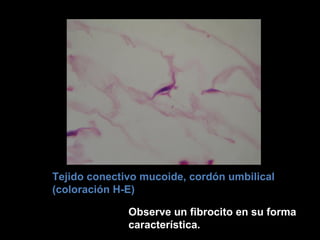                                                                                   Tejido conectivo mucoide, cordón umbilical (coloración H-E)  Observe un fibrocito en su forma característica.  