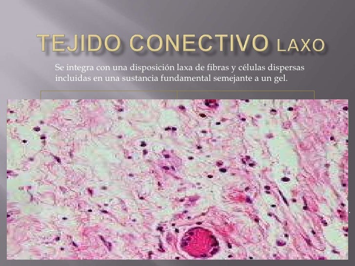 Tejido conectivo