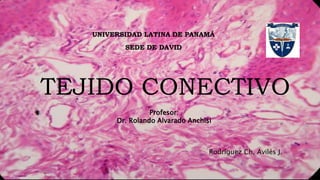 TEJIDO CONECTIVO
UNIVERSIDAD LATINA DE PANAMÁ
SEDE DE DAVID
Profesor:
Dr. Rolando Alvarado Anchisi
Rodríguez Ch, Avilés J.
 