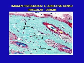 IMAGEN HISTOLOGICA: T. CONECTIVO DENSO
IRREGULAR - DERMIS
 