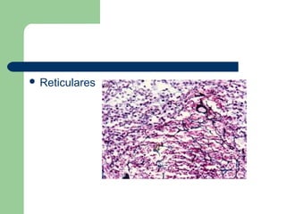  Reticulares
 