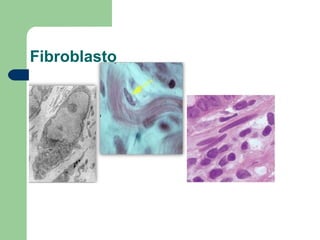 Fibroblasto
 