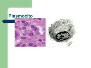 Plasmocito
 