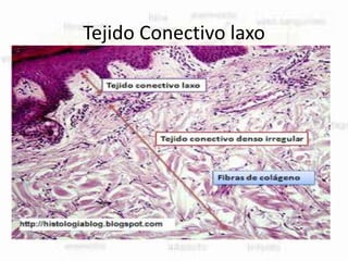 Tejido Conectivo laxo
 