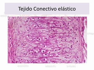 Tejido Conectivo elástico
 