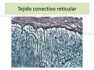 Tejido conectivo reticular
 