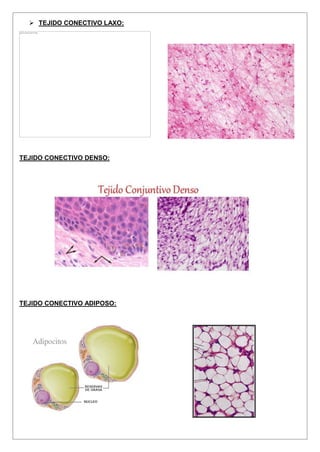  TEJIDO CONECTIVO LAXO:
TEJIDO CONECTIVO DENSO:
TEJIDO CONECTIVO ADIPOSO:
 