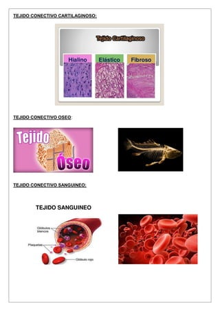 TEJIDO CONECTIVO CARTILAGINOSO:
TEJIDO CONECTIVO OSEO:
TEJIDO CONECTIVO SANGUINEO:
 