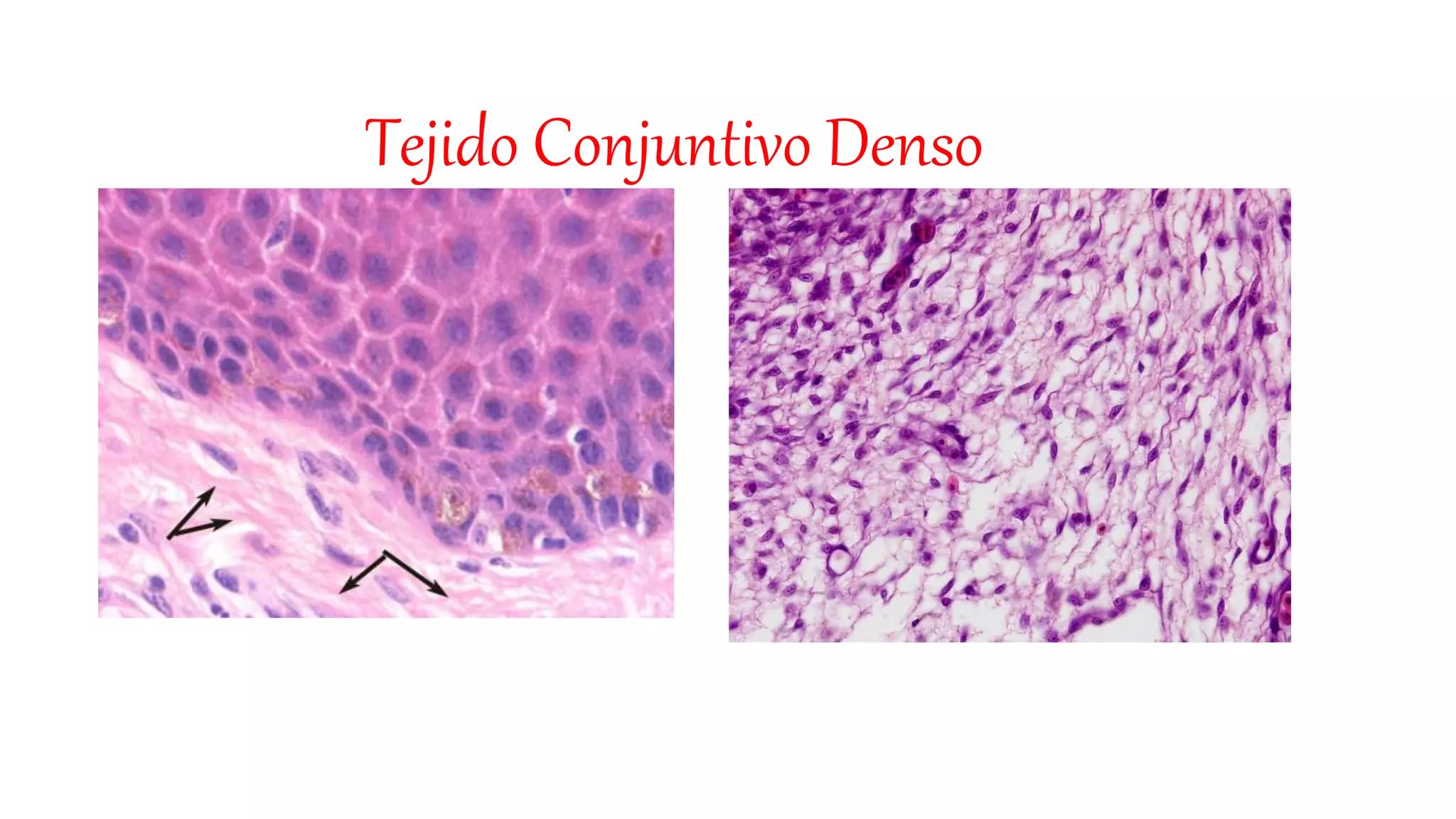 Tejido conectivo denso | PPTX