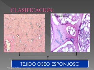 TEJIDO OSEO ESPONJOSO 
Trabajo de histology - grupo cesar 
 
