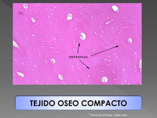 TEJIDO OSEO COMPACTO 
Trabajo de histology - grupo cesar 
 