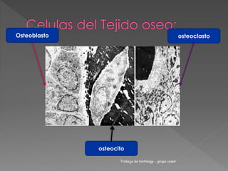 Osteoblasto 
osteocito 
osteoclasto 
Trabajo de histology - grupo cesar 

