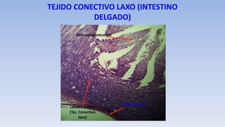 TEJIDO CONECTIVO LAXO (INTESTINO
DELGADO)
Vellosidad intestinal
Lámina propia
(Tej. Conectivo
laxo)
Músculo liso
 