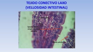 TEJIDO CONECTIVO LAXO
(VELLOSIDAD INTESTINAL)
Lámina propia
Epitelio cilíndrico
simple con chapa
estriada
Célula caliciforme
 