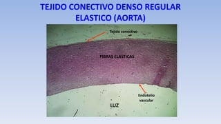 TEJIDO CONECTIVO DENSO REGULAR
ELASTICO (AORTA)
LUZ
Endotelio
vascular
FIBRAS ELASTICAS
Tejido conectivo
 
