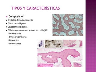  Composición
● Cristales de hidroxiapatita
● Fibras de colágeno
● Glucosaminoglicanos
● Células que renuevan y absorben el tejido
-Osteoblastos
-Osteoprogenitoras
-Osteocitos
-Osteoclastos