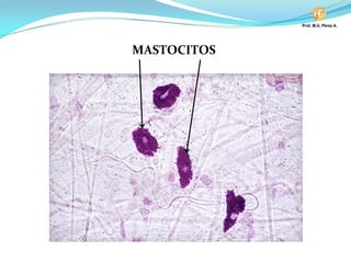 MASTOCITOS
 