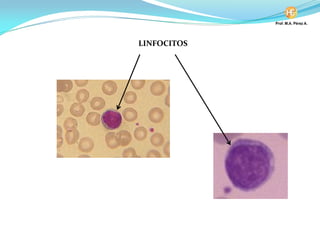 LINFOCITOS
 