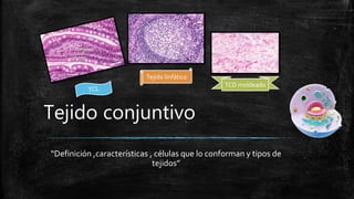 Tejido conjuntivo
“Definición ,características , células que lo conforman y tipos de
tejidos”
TCD moldeado
Tejido linfático
 