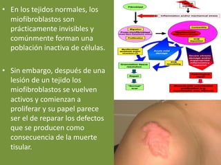 • En los tejidos normales, los
miofibroblastos son
prácticamente invisibles y
comúnmente forman una
población inactiva de células.
• Sin embargo, después de una
lesión de un tejido los
miofibroblastos se vuelven
activos y comienzan a
proliferar y su papel parece
ser el de reparar los defectos
que se producen como
consecuencia de la muerte
tisular.
 