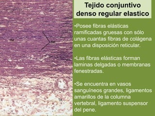 Tejido conjuntivo
denso regular elastico
•Posee fibras elásticas
ramificadas gruesas con sólo
unas cuantas fibras de colágena
en una disposición reticular.
•Las fibras elásticas forman
laminas delgadas o membranas
fenestradas.
•Se encuentra en vasos
sanguíneos grandes, ligamentos
amarillos de la columna
vertebral, ligamento suspensor
del pene.
 
