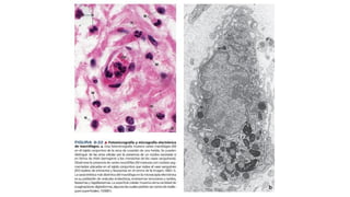 Comprehensive Overview of Connective Tissue Structure and Function in ...